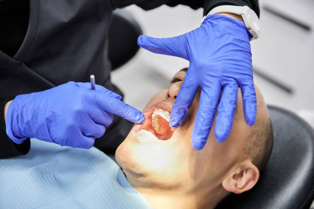 Best Knocked-Out Tooth Emergency  in Ashville, AL